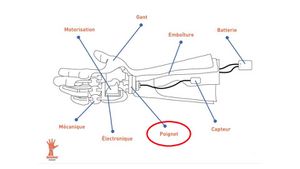 Schema description prothese.jpg