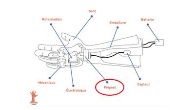 Schema description prothese.jpg